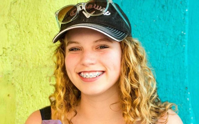 devojka-osmeh-fiksna-proteza devojka-osmeh-fiksna-proteza