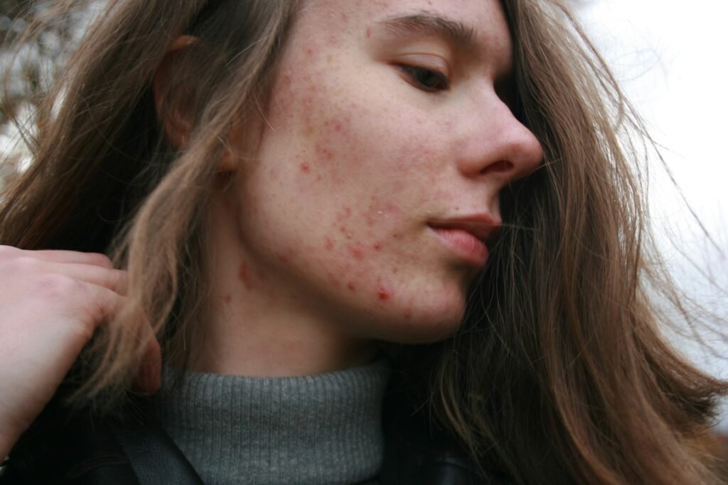 zena-crvenilo-lice